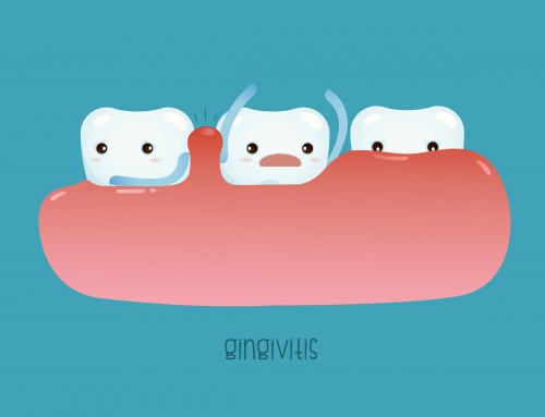 ¿Qué es y cómo puedo prevenir la gingivitis?