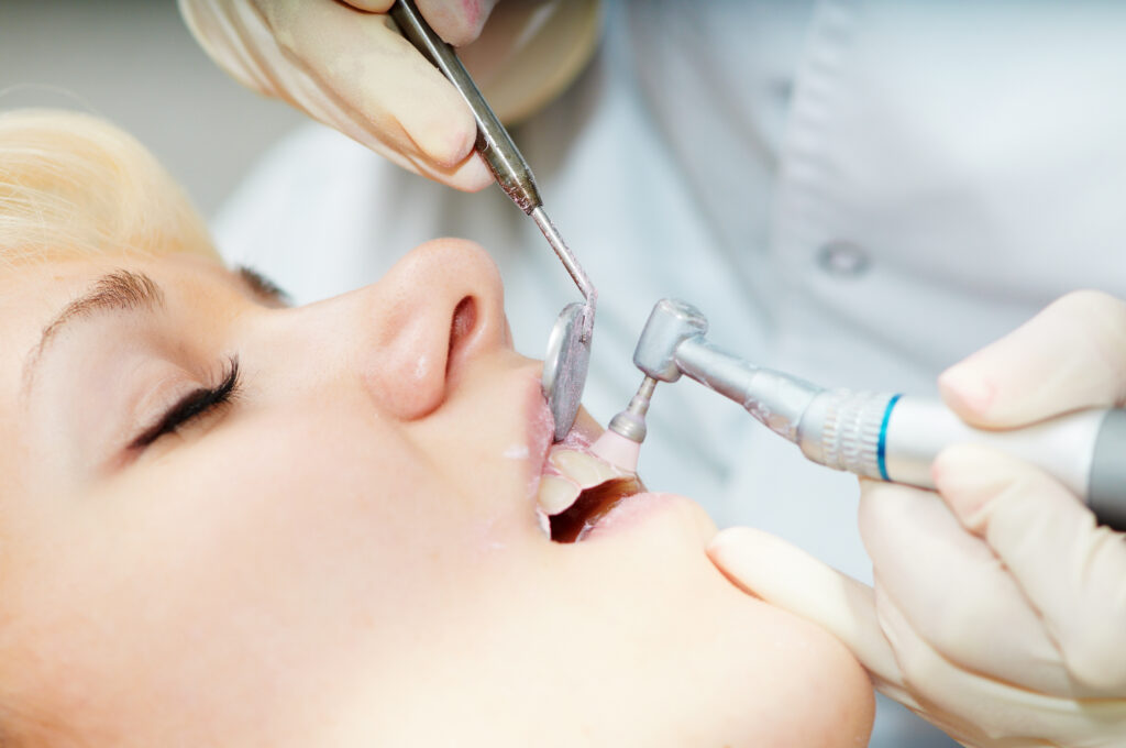 Extracción dental en Majadahonda
