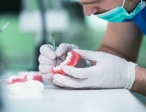¿Cuánto tiempo puede durar un implante dental?